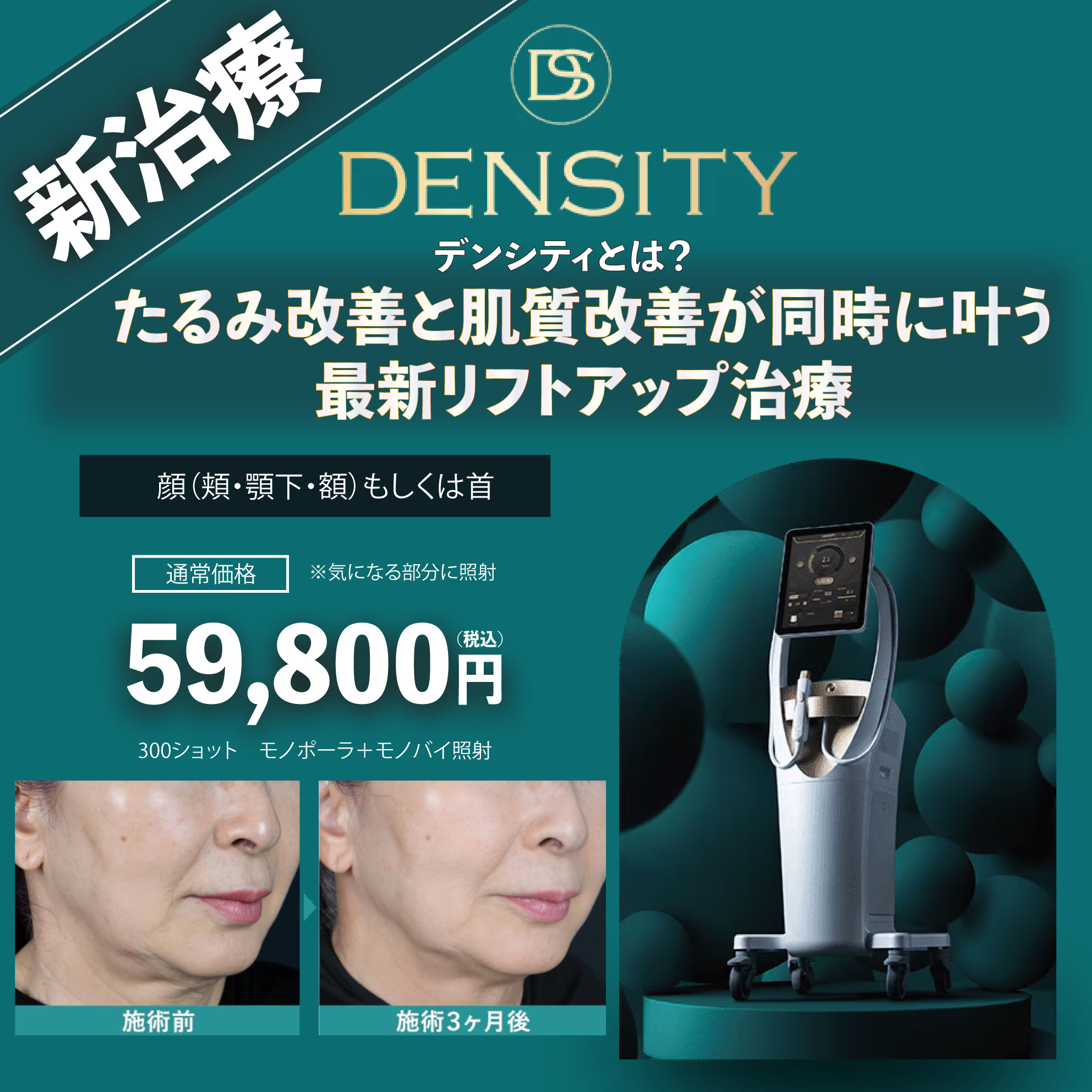 たるみ改善と肌質改善が同時に叶う、最新リフトアップ治療とは？